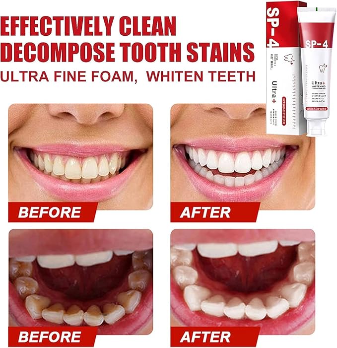 SP-4 ultra Whitening Probiotic Paste